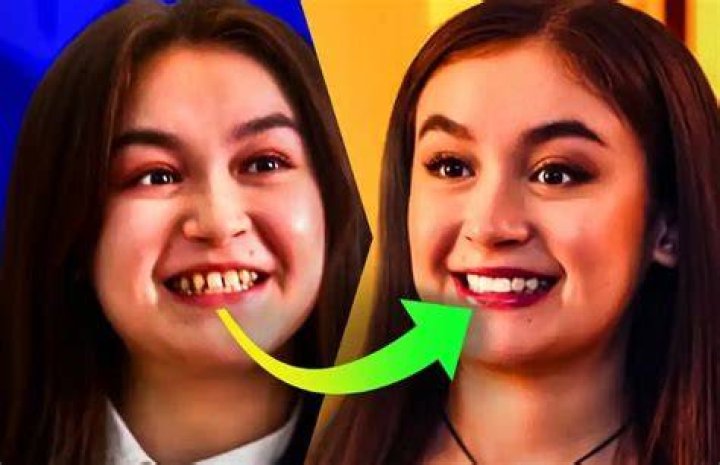 Anna, 25, had extensive teeth work
