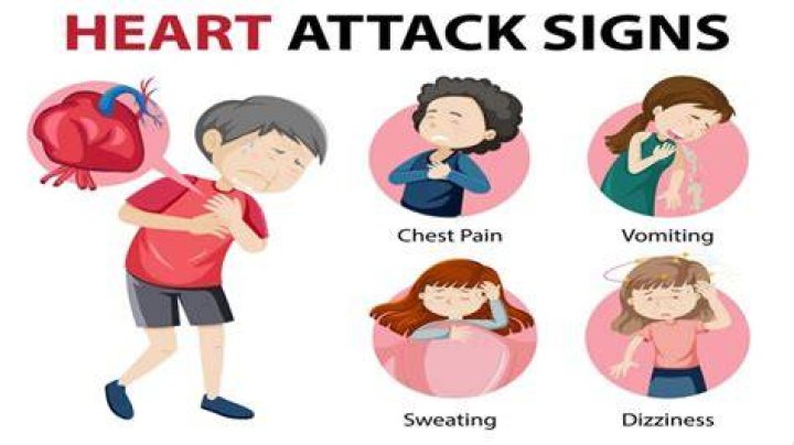 Can dancing trigger heart attack
