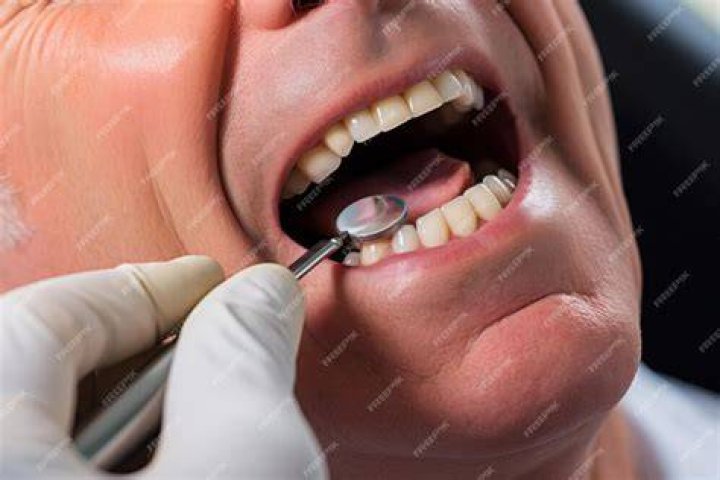 dentist checkup teeth gap