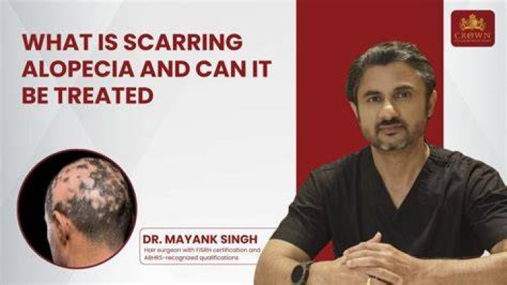 Dr Popov says the scarring will be minimal once healed