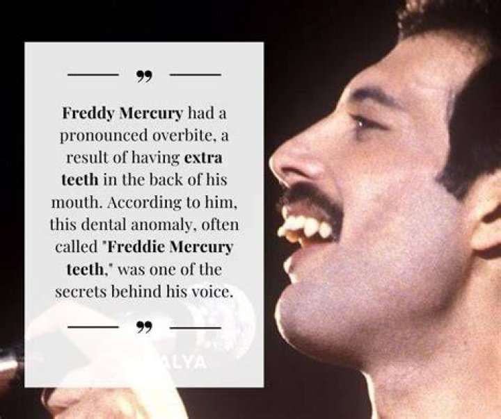 He also had his teeth whitened and looked very LA, having lived out there