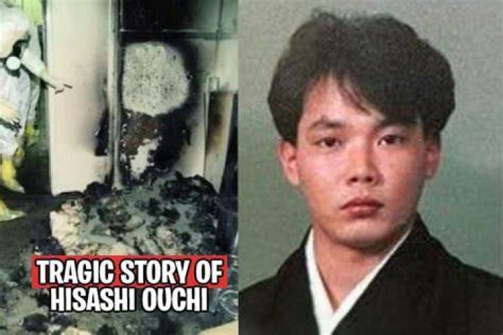 Hisashi Ouchi Story The Tragic Tale Of A Nuclear Accident Survivor