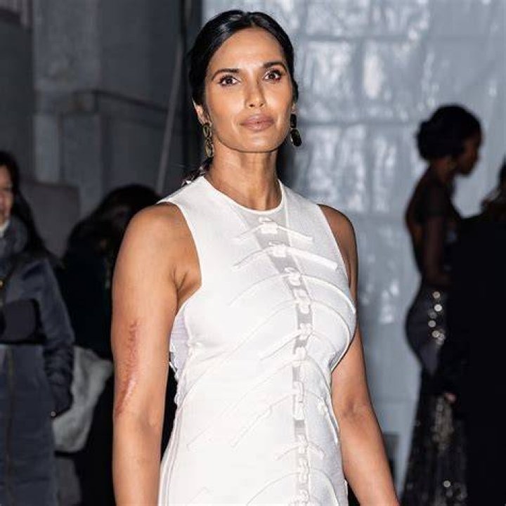 How Padma Lakshmi&rsquo;s Arm Scar Became a Part of Who She Is