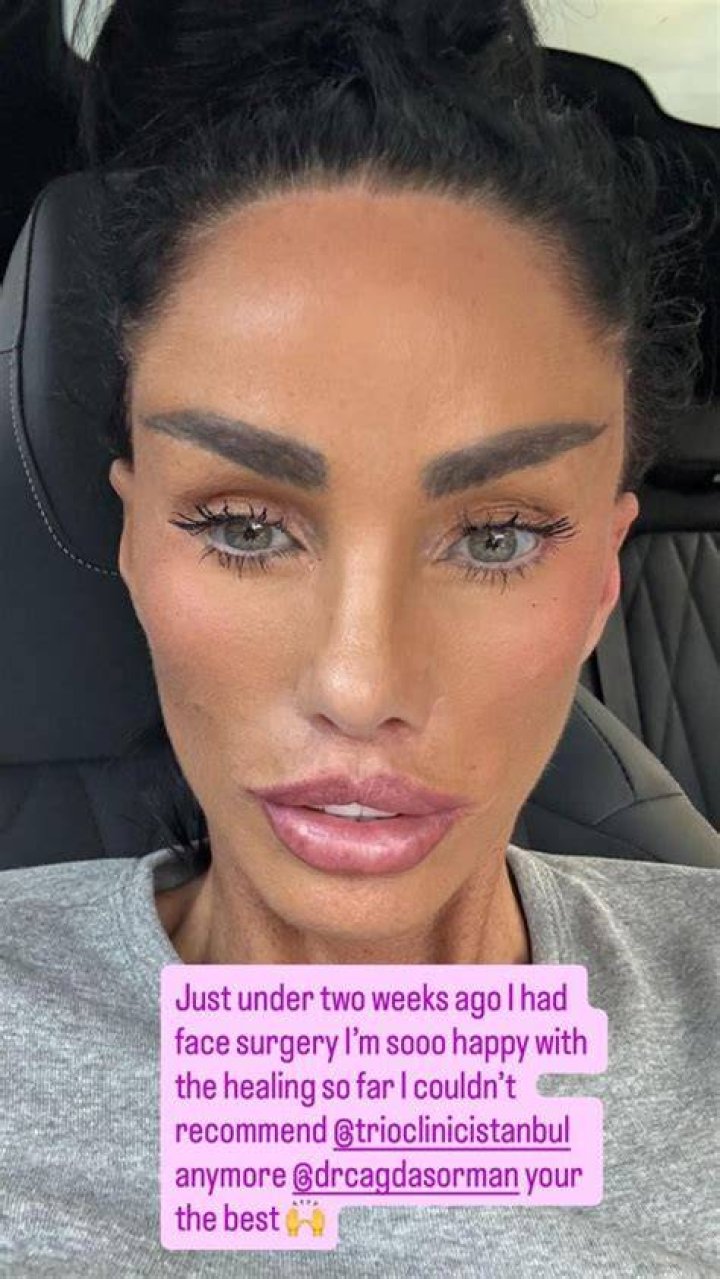 Katie Price is currently recovering after breaking both of her feet