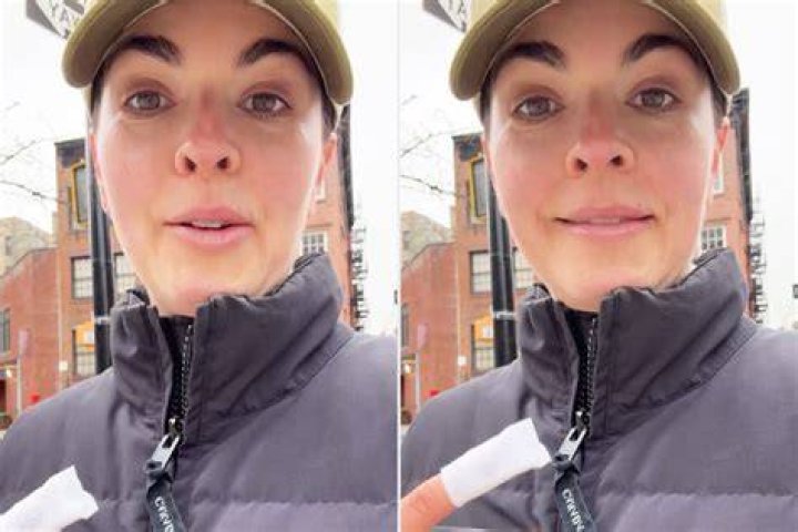 Katie suffered the injury while in Turkey with boyfriend Carl Woods and two of her kids