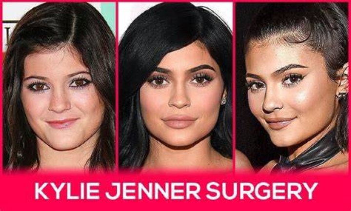  Kylie had surgery to kick start her weight loss