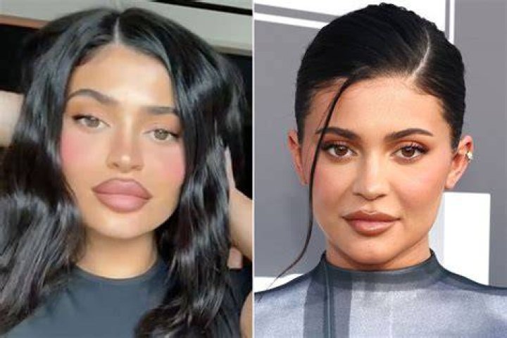 Kylie Jenner 2024 Lips Colly