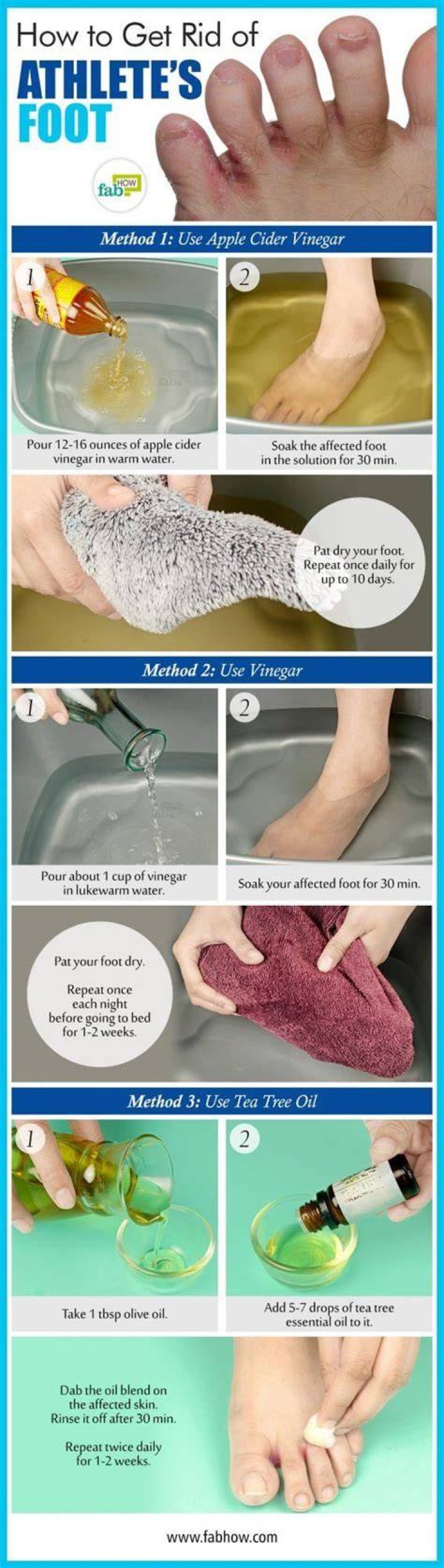 Question: How To Get Rid Of Athlete's Foot Diy