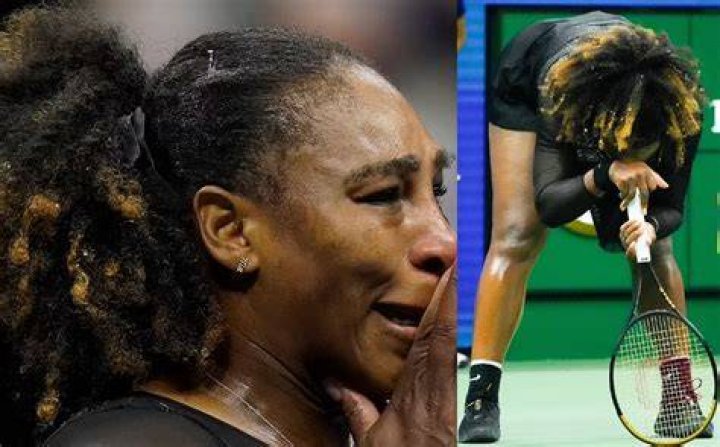 Serena Williams Breaks Down Totally Weird Method of Soothing Her Sunburn
