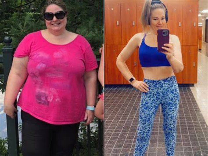 She slimmed down to 160lbs after gastric surgery