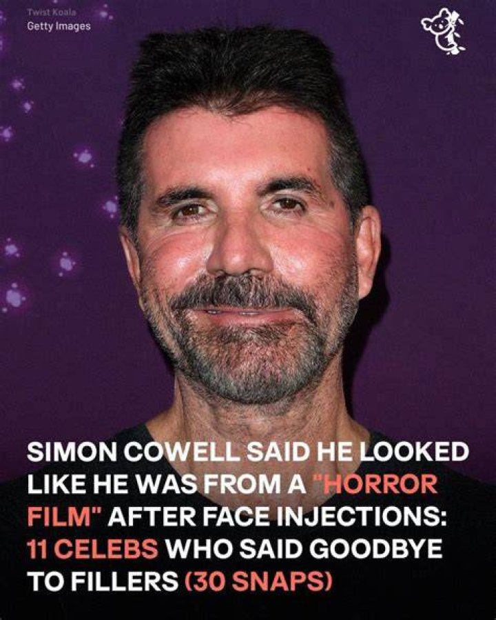 Simon said he's stopped using Botox or injectables due to son Eric's reaction to his face
