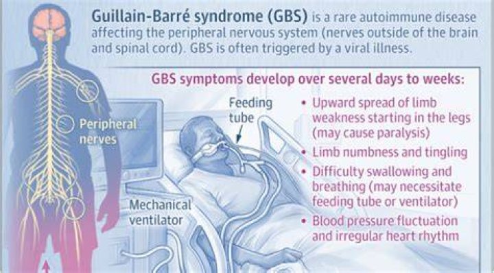 Surviving GuillainBarr&eacute; Syndrome a PEOPLE Writer's Story