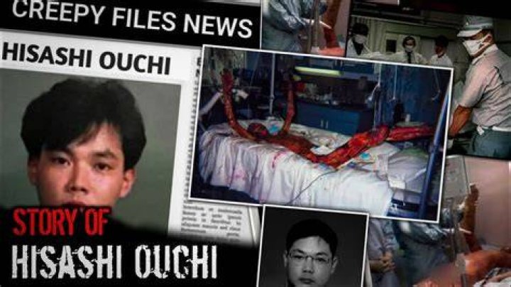 The Tragic Case Of Hisashi Ouchi A Deep Dive Into Nuclear Accident And