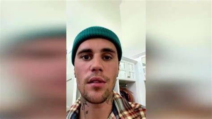 Twarz Justina Biebera sparaliżowana po zdiagnozowaniu rzadkiego