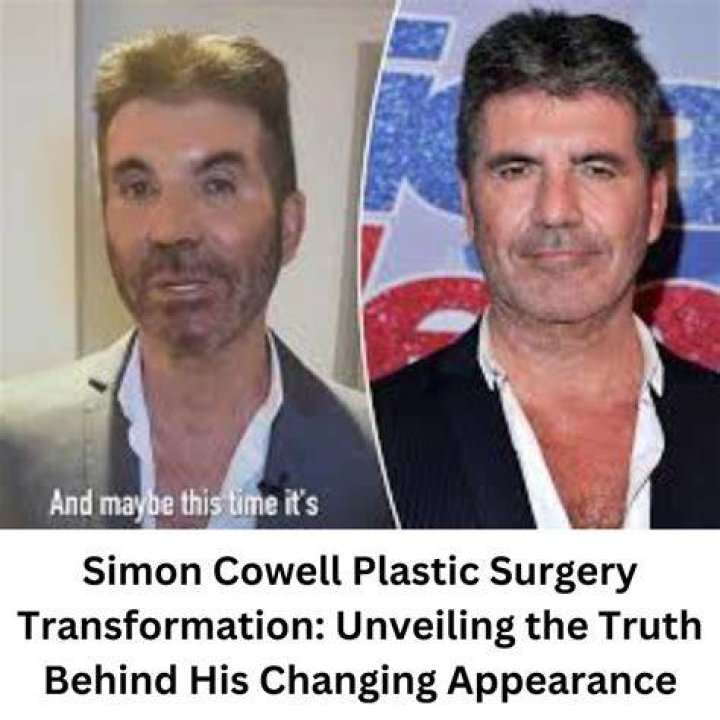 Unveiling The Truth Behind Simon Cowell's Son Health Condition